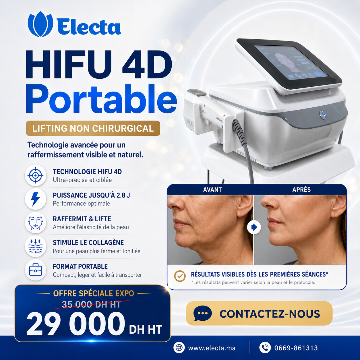 ELECTA HIFU 4D